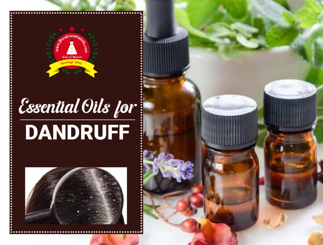 essential oils for dandruff