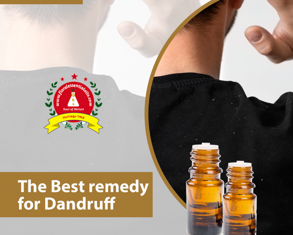 The Best remedy for Dandruff Olive Oil Floral Essential Oils