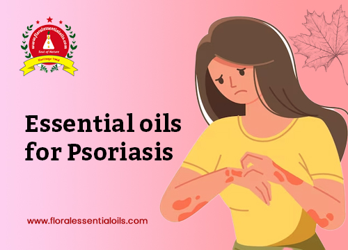 Essential oils for Psoriasis